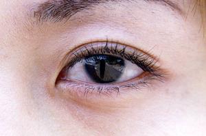 心斎橋で最適な美容治療を見つける方法